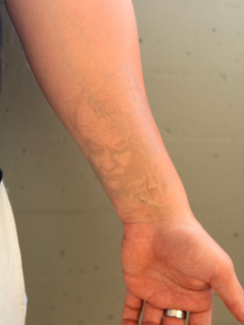 Tatuaggio appena applicato